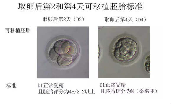 可移植胚胎的标准