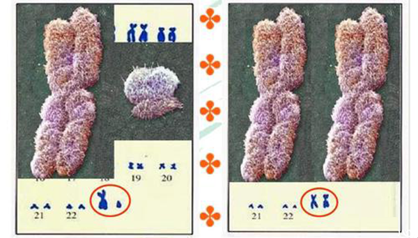 生男生女取决于男性染色体（图左男性、图右女性）